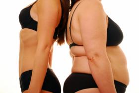 Anorexia nerviosa