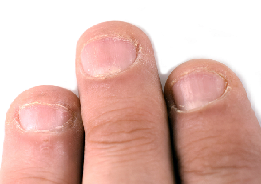 antiguo Goma Isaac Mi hijo se come las uñas. Un hábito que puede tener complicaciones | Familia y Salud antiguo Goma Isaac Mi hijo se come las uñas. Un hábito que puede tener complicaciones | Familia y Salud
