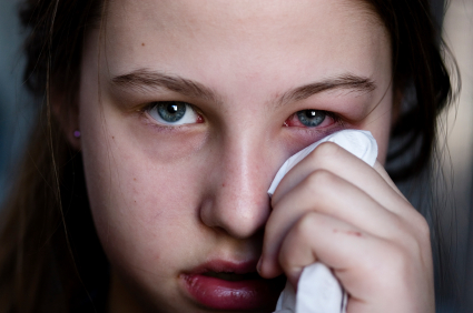 Por qué no deberías dormir con el aire acondicionado puesto 2 Moncloa conjuntivitis Moncloa