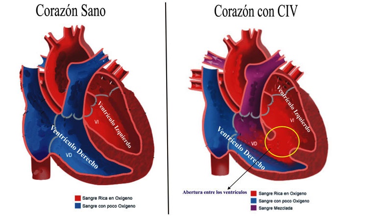 Resultado de imagen de Cardiopatías Congénitas