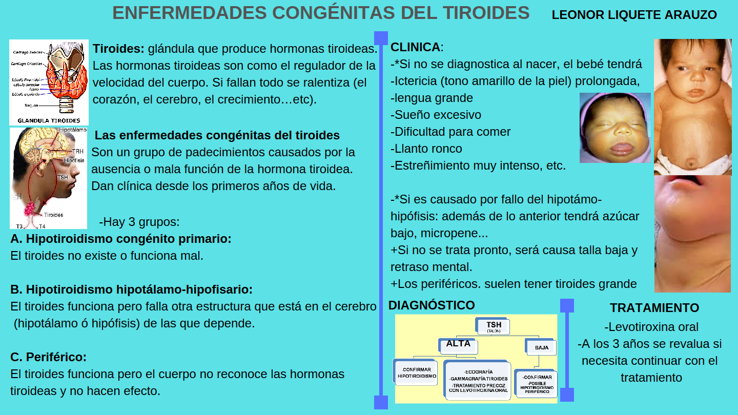 tiroides alta en niños
