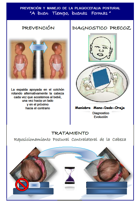 Plagiocefalia postural cojín best sale
