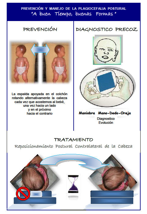 Plagiocefalia: ¿Cómo prevenir y tratar la cada vez más frecuente deformidad  de cabeza de los bebés?