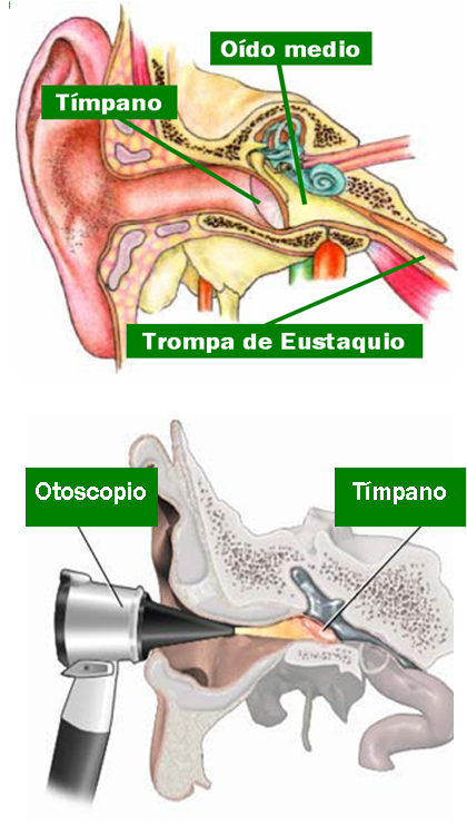 Limpieza de Oídos: qué es, síntomas y tratamiento