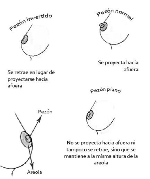 Problemas en el pezon durante la lactancia