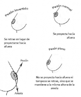 acre Araña de tela en embudo eficaz Podré dar el pecho con los pezones planos? | Familia y Salud